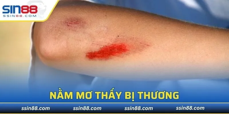 Nằm Mơ Thấy Bị Thương
